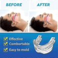 thumbnail image 3 of Adjustable Anti Snoring Mouthpiece Guard Anti Snore Sleep Apnea Teeth Grind, 3 of 5