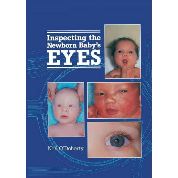 Inspecting the Newborn Baby's Eyes, (Paperback)