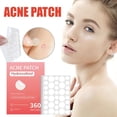thumbnail image 3 of Acne Patch Mild And Non-irritating Lighten Acne Comedones Light Acne Patch Closed And L4e9, 3 of 7