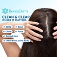 thumbnail image 4 of Sérum Calmante Roycederm para Dermatitis Seborreica y Psoriasis 120 ml, 4 of 8