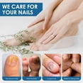 thumbnail image 4 of IBeaLee nail polish antibacterial liquid, nail polish powder, nail polish fungus, nail polish antibacterial agent, 4 of 5
