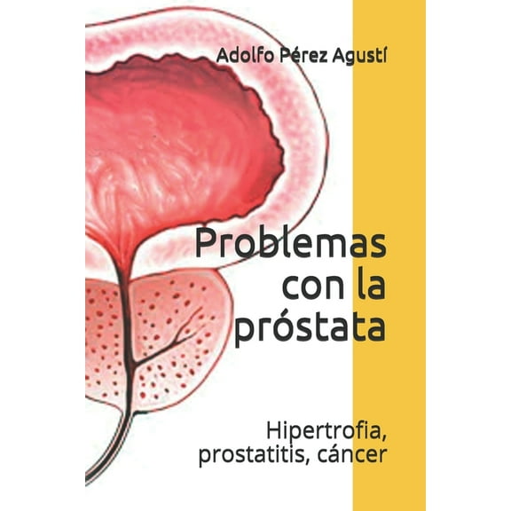 Tratamiento Natural: Problemas con la próstata: Hipertrofia, prostatitis, cáncer (Paperback)