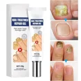 thumbnail image 4 of Crema para tratamiento de hongos en las uñas, onicomicosis, paroniquia, antiinfección, hongos en los dedos de los pies, manos, eliminación, Gel de reparación, cuidado, belleza, salud, 4 of 5