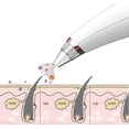thumbnail image 2 of Jinsinto Visual Blackhead Pore Cleaner, Electric Blackhead Suction And Pore Cleaner, 2 of 7