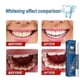 thumbnail image 5 of 1 unidad con caja, bolígrafo blanqueador de dientes de 3ml, suero de limpieza, eliminador de manchas de placa, blanqueador dental, cuidado de higiene bucal Hs, 5 of 5