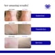 thumbnail image 4 of Rejuvaskin Rejuvasil Gel De Silicona Para Cicatrices - Tratamiento De Cicatrices Para Cicatrices Quirúrgicas Para Cara, Cuerpo, Queloides Y Cicatrices De Acné - Gel De Silicona Para Cicatrices Para Re, 4 of 9