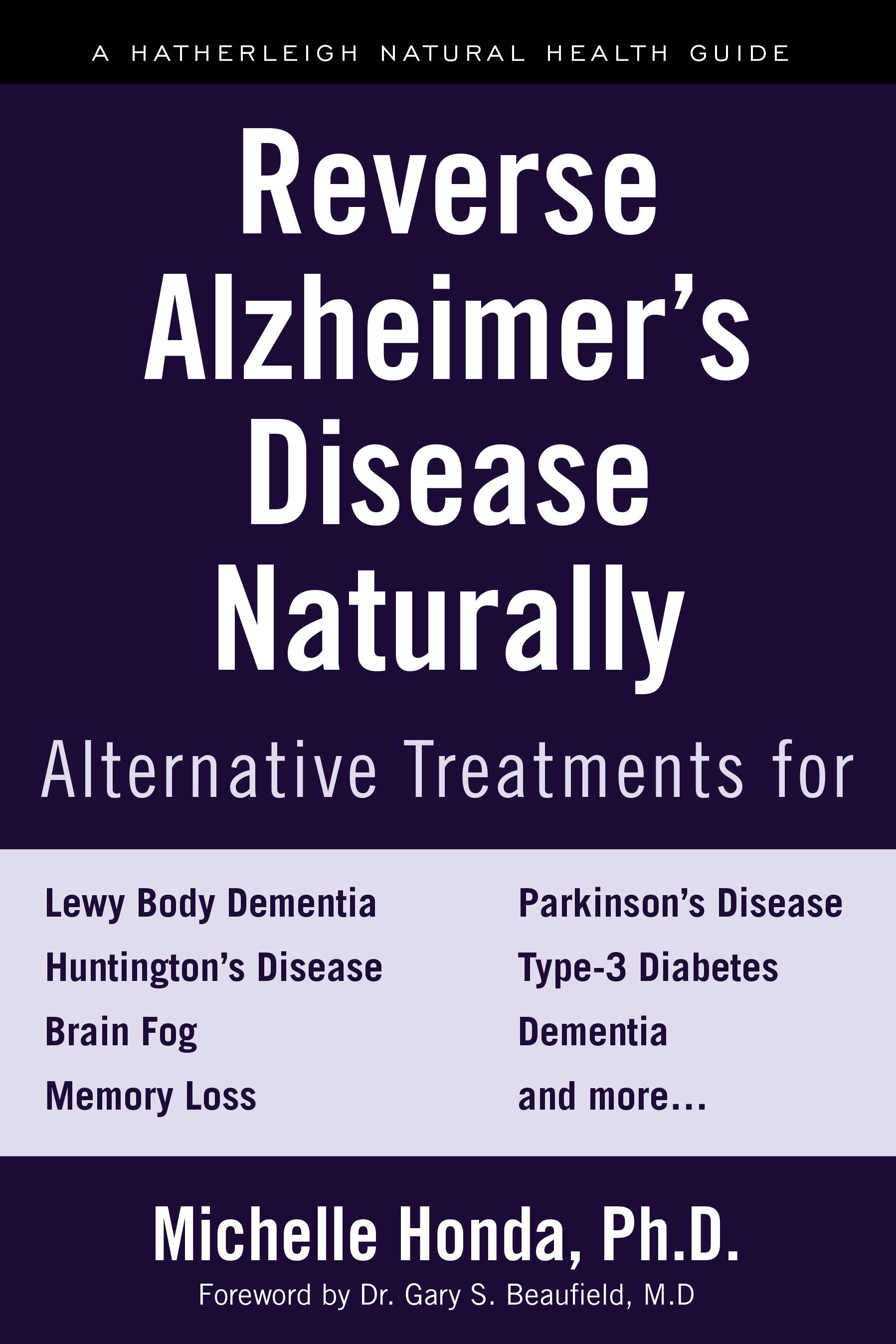 Targets for the treatment of Alzheimers disease