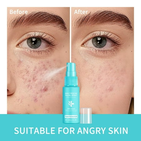 MUAXDA Facial Spray, Daily Rescue Facial Spray for Sensitive Skin, Refreshing Facial Mist, Water Spray for All Skin Types, Face Mist that Hydrates, Rejuvenates & Clarifies