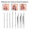 thumbnail image 5 of Herramienta para quitar espinillas, extractores de acné, removedor de imperfecciones, pinzas para pelo encarnado, Kit de eliminación de espinillas, removedor de espinillas 8 en 1, 5 of 5