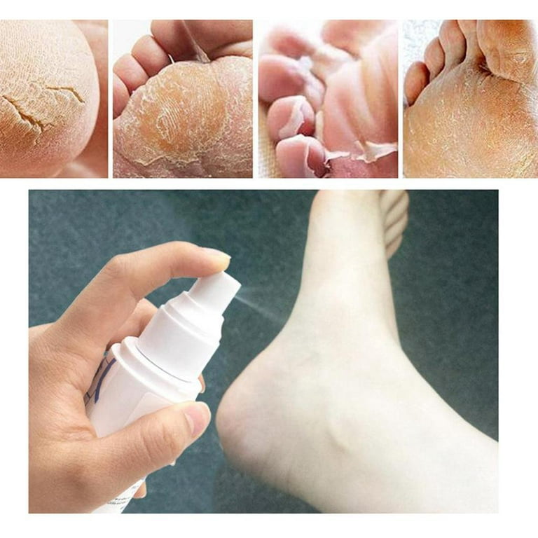 Dr. Entre's Callus Remover Gel Kit for Feet: Foot File, Pumice