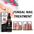 thumbnail image 2 of Nail Repair Liquid Thickening And Bright Nails, 2 of 5
