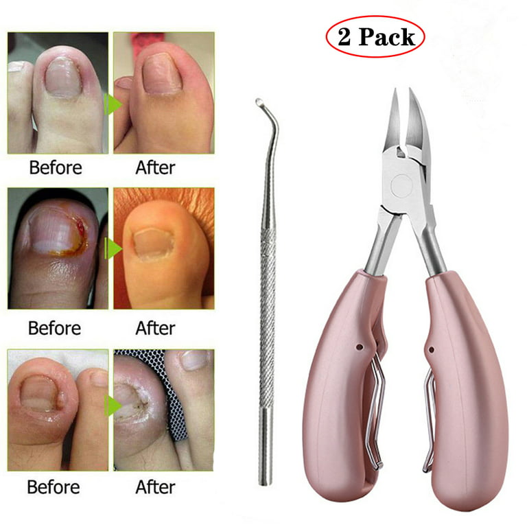 2 Pack Toenail Clippers for Thick, Fungal or Ingrown Toenails, Heavy Duty Easy Grip Resin Handle Podiatrist Style Toenail Clipper Ingrown Toenail Tool