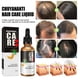 thumbnail image 5 of Aceite para el crecimiento del cabello de 30 ml que nutre el cuero cabelludo, crecimiento rápido del cabello, solución nutritiva para el cuidado del cabello anticaída., 5 of 5