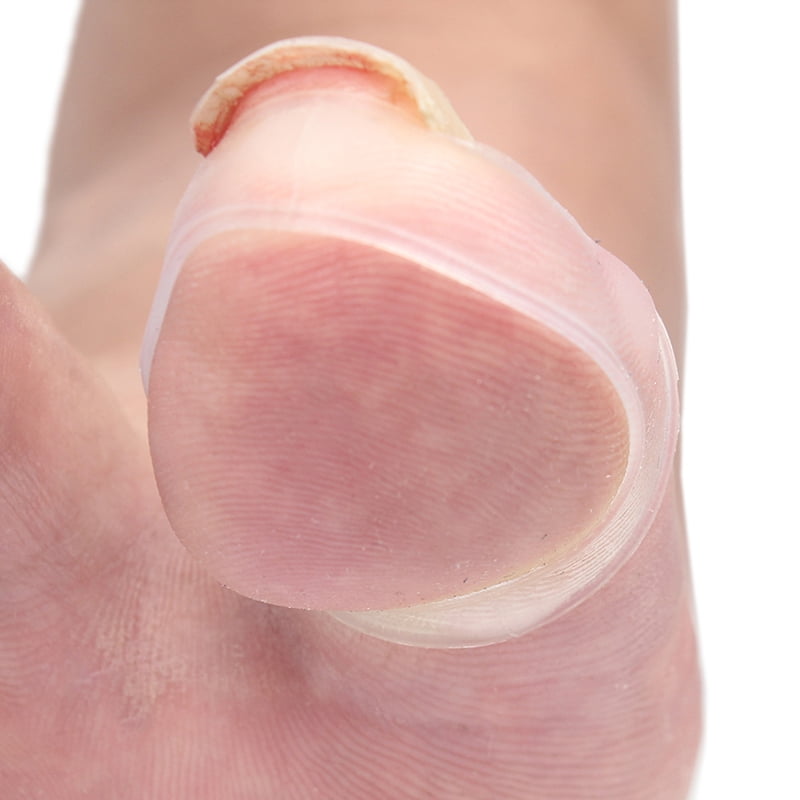 10pcs silicona Toe Nail correction drogadictos legiones enquistados dedos del pie clavo corrector 