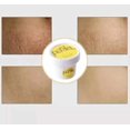 thumbnail image 3 of Pack 2 Cremas Pasjel para Estrias y Cicatrices, 3 of 4