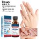 thumbnail image 5 of Fiudx Ofertas Relámpago Juego De Reparación De Uñas Extra Fuerte Para Uñas De Los Pies, Cuidado De Las Uñas De Los Pies, Reparación De Uñas Rotas Dañadas, 10Ml, 5 of 6