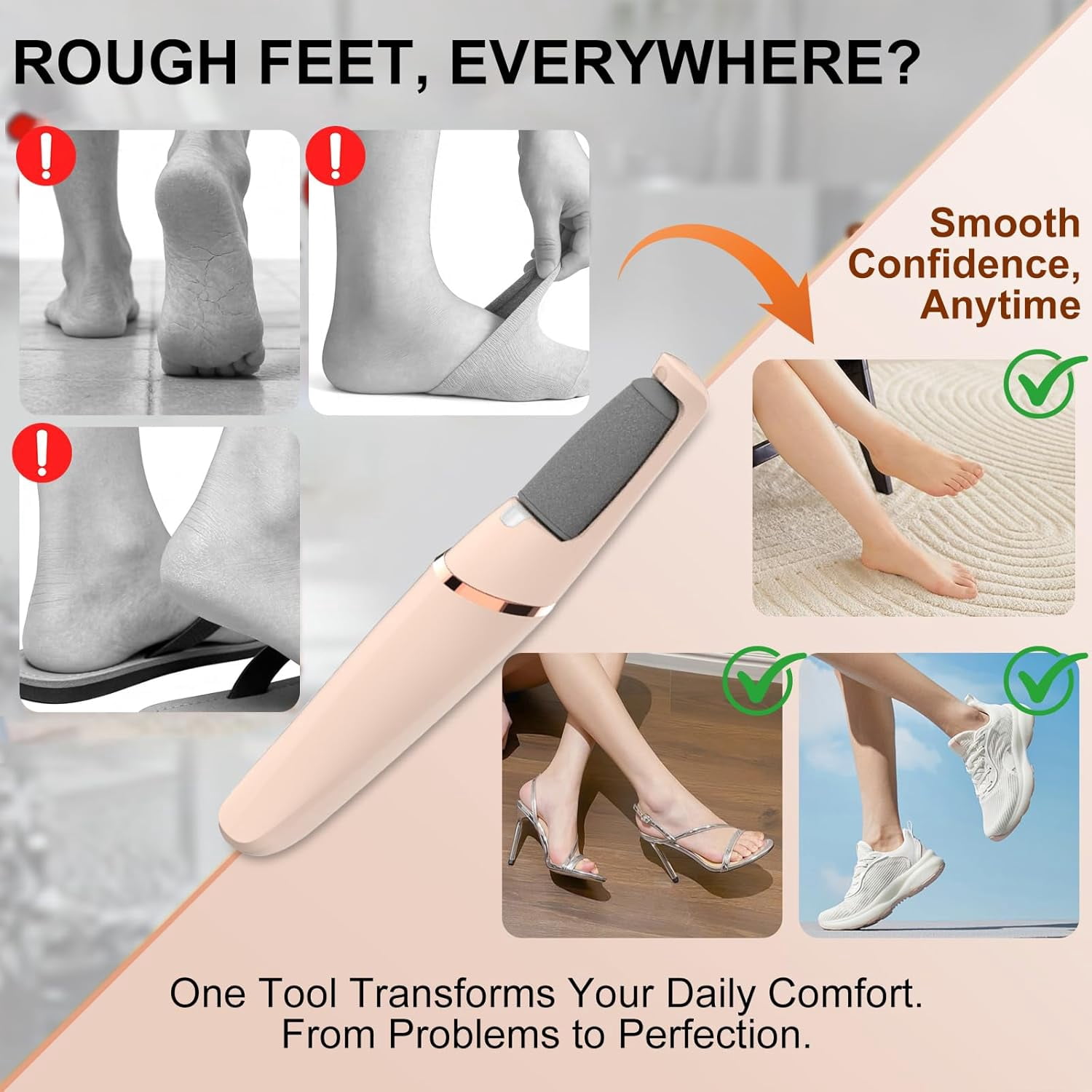 Aorsher Electric Callus Remover with 2 Durable Heads, Rechargeable Professional Cordless Hard Skin Removal for Dry &Dead Cracked Skin, Foot Pedicure Tool for Feet