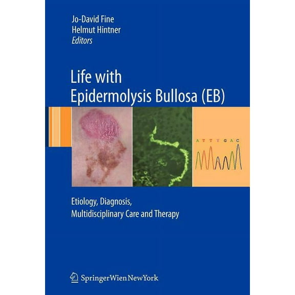 Life with Epidermolysis Bullosa (Eb): Etiology, Diagnosis, Multidisciplinary Care and Therapy, (Paperback)