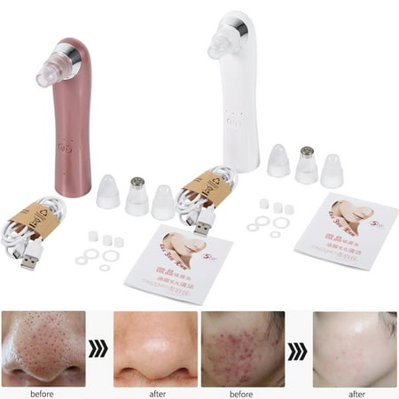 Ejoyous Electric  Skin Pore Cleaner Nose Blackhead Suction