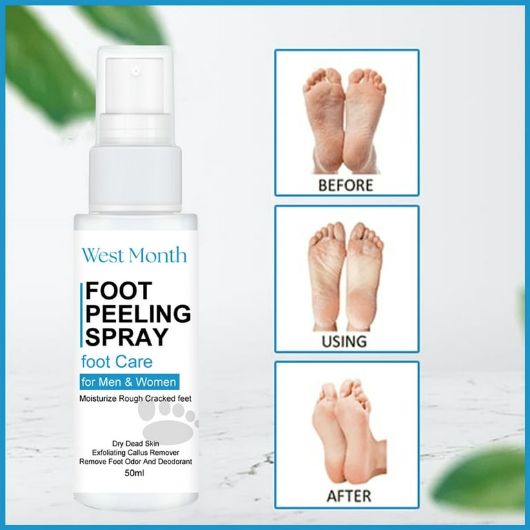 Peeling Dry Skin On Feet Treatment Foot Peeling Spray Oil Foot