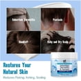 thumbnail image 3 of Scalp Soothing Cream - Nourishing Care, Reduces Dandruff & Itch Relief 100ml, 3 of 5