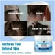thumbnail image 3 of Scalp Soothing Cream - Nourishing Care, Reduces Dandruff & Itch Relief 100ml, 3 of 5