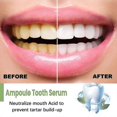 thumbnail image 2 of 1pc Teeth Whitening Essence Cleans Tooth Stains Mouth Odor Beautiful Teeth Brightening Teeth Cleaning Essence, 2 of 4