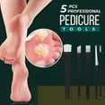 thumbnail image 4 of Professional Foot Callus Remover Tool Set Toe Manicure Pedicure Knife Cutterss S7L5, 4 of 6