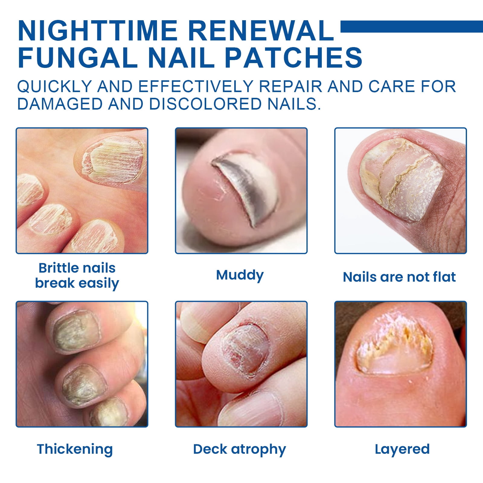 Alvantor Fungal Nail Patches, Overnight Repair for Damaged Thick Toenails, 8-Hour Treatment, 32PCS