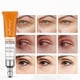 thumbnail image 4 of Reducir las ojeras debajo de los ojos y las líneas finas Vc Eye Cream-niubi, 4 of 5