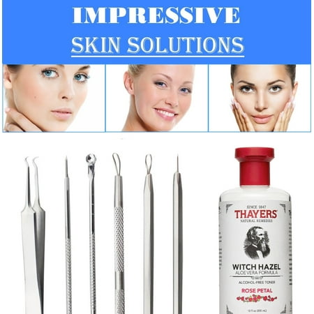 Thayers Witch Hazel Aloe Vera toner, Rose Petal, 12 fl oz + Blackhead Remover Tool Kit Set 6 PCS Professional Surgical Stainless Steel Extractors for Face and Body (Best Toner For Blackheads)