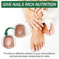 thumbnail image 2 of 30ml Toenail Care Solution, Toenail Repair Solution, Nail Fungus Treatment, Soft Nail Ingrown Toenail Care Solution, 2 of 5