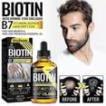 thumbnail image 2 of 3x Biotin Hair Growth Oil Vitamin B7 Hair Essential Oil Treatment Preventing Loss Restorer Essential Oil 30ml, 2 of 5