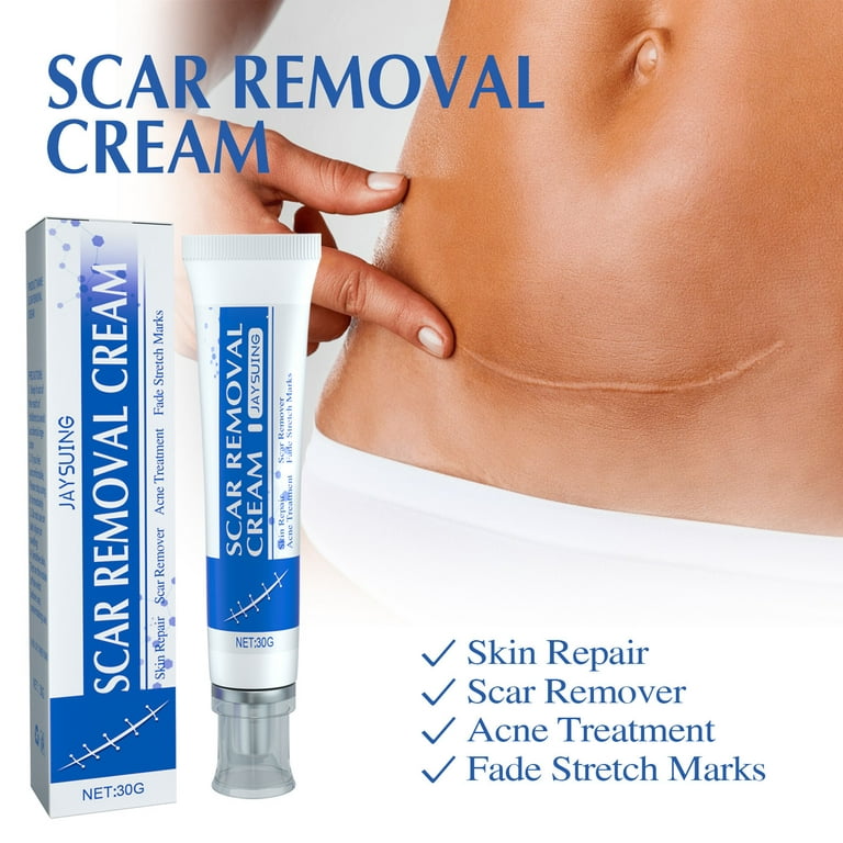 GHPKS Gentle Scar Removal Paste, Scar Repairing Diminishing Skin Scar Gel,  Scar Reduce Paste For All Skin Types