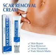 LAOSR Gentle Scar Removal Paste, Scar Repairing Diminishing Skin Scar Gel, Scar Reduce Paste for All Skin Types Buy 2 Ship 3