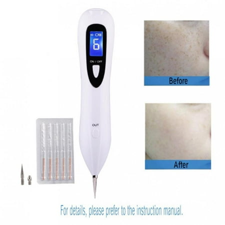 Fosa Dot Mole Removal Pen, Freckles, Senile Plaques, Tattoo Pigmentation Skin Tag Nevus Removing LCD Display Beauty Device No Bleeding, USB Charging, Spot Removal Device, Mole Removal