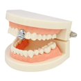 thumbnail image 3 of Single Teeth Grillz Cap Set Decorative Bottom Grill Rhinestone Top Teeth Grillz, 3 of 10