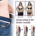 thumbnail image 4 of Sl Chang Abdominal Lifting Patches293, 4 of 5