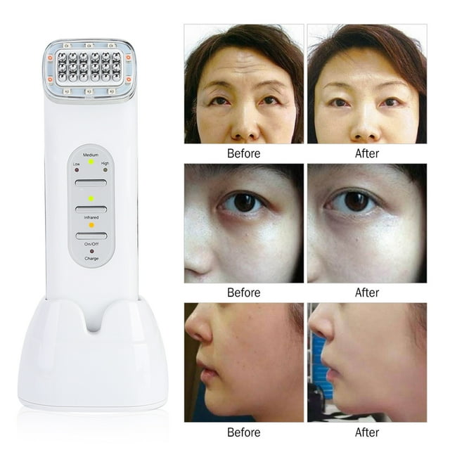 Máquina facial de radiofrecuencia, máquina facial RF de punto de radiofrecuencia RF Máquina de masaje RF Durabilidad probada en el tiempo