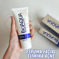 thumbnail image 2 of Removedor Limpiador De Acne Y Grasa Bioaqua Pure Skin UNIVERSOENLINEA.COM, 2 of 4