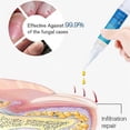 thumbnail image 4 of Gel antimicótico para uñas, antiinfecciones, para uñas infectadas, tiña de las uñas, 1 unidad, 4 of 5