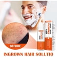 thumbnail image 4 of DPTALR Hair Removal Cream Bump Stopper Ingrown Hair Shave Reduce Dark Spots Redness Burns Solution 20ML, 4 of 8