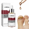 thumbnail image 2 of Tratamiento antifúngico casero: esencias líquidas para el cuidado de las bacterias de las uñas de manos y pies, 15 ml, 2 of 8