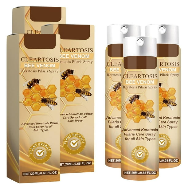 Clearance Sale Body Acne Removing Cleaning Spray For Back, Neck, Waist Acne Removing And Diminish Inflammation 20ml, Beauty & Personal Care