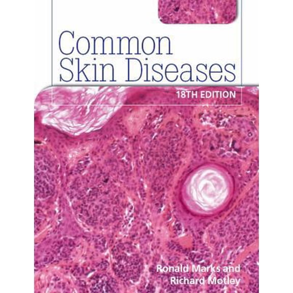 Pre-Owned Common Skin Diseases 18th Edition: Ise (Hardcover) 0340983507 9780340983508