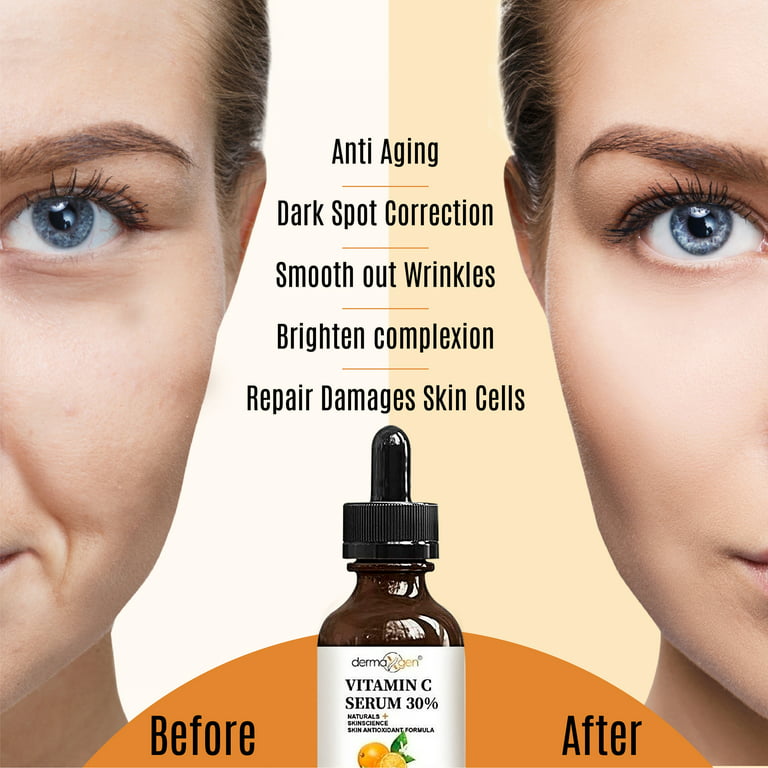 Dermaxgen 30% Vitamin C Serum for Face, Hyaluronic Acid + Vitamin (B3 + E) + Jojoba + Aloe Vera- Natural & Organic Anti Wrinkle & Skin Rejuvenator