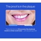 thumbnail image 5 of Pasta Dental Espumosa de Menta Autobrush para Adultos, Paquete de 3, 5 of 6