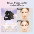 thumbnail image 4 of Máscara facial y para cuello de luz roja Yahi con control remoto, 4 of 8