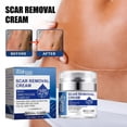 thumbnail image 1 of Crema reparadora Cicatrices Crema aclarante Crema reparadora de cicatrices Crema reparadora de piel Natural, 1 of 8