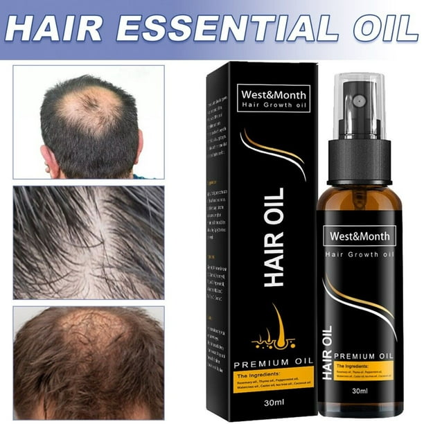Fast Hair Growth Loss Serum Essential Oil Nourishing Anti Hair Loss  Treatment - Walmart.com